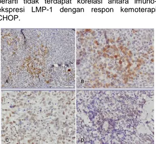 Tabel  2.  Distribusi  respon  kemoterapi  CHOP  ber- ber-dasarkan tingkat imunoekspresi LMP-1
