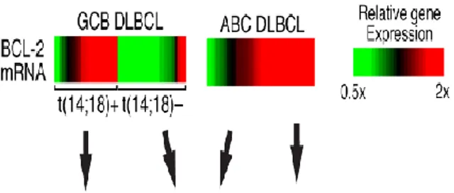 Gambar  2.  Mekanisme  ekspresi  Bcl-2.  Pada  diffuse  large  B-cell  lymphoma  subtipe  GCB  ekspresi  Bcl-2  terjadi  melalui  translokasi  dan  amplifikasi  gen,   se-dangkan pada subtipe non-GCB (ABC) terjadi melalui  amplifikasi  gen  dan  aktivasi  