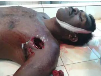 Gambar 2.3-1: Petrus Ayamiseba ditembak oleh aparat polisi dalam  demonstrasi di Timika