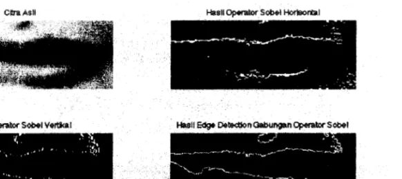 Gambar 3.  Hasil  edge detection  menggunakan operator Sobel 