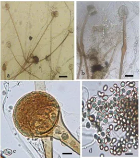Gambar 4  Rhizopus delemar: (a) sporangiofor yang muncul dari miselium udara 