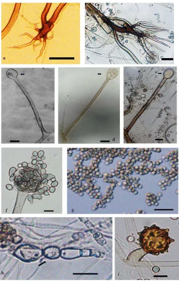 Gambar 5    Rhizopus microsporus: (a) rizoid sederhana, (b) rizoid berkembang dengan baik, sporangiofor yang tumbuh dari stolon, dengan kolumela  