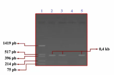 Gambar 4.1. Hasil deteksi produk PCR dengan elektroforesis gel agarosa.