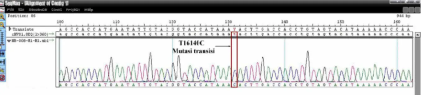 Gambar 4.3. Contoh tampilan analisis mutasi pada sampel NB-008 dengan menggunakan program SeqMan DNASTAR.