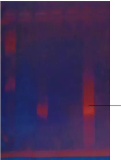 Gambar  12.Hasil  deteksi  produk  PCR  dengan  elektroforesis  gel  agarosa  sampel  produk  PCR  folikel  akar  rambut  dengan  primer  M1  M2