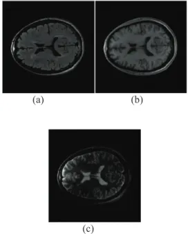 Gambar 3 Citra MRI: (a) PD (b) T1 (c) T2