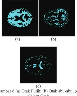 Gambar 6 (a) Otak Putih; (b) Otak abu-abu; (c)  Cairan Otak 