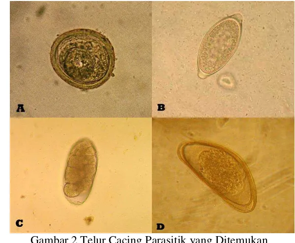 Gambar 2 Telur Cacing Parasitik yang Ditemukan 