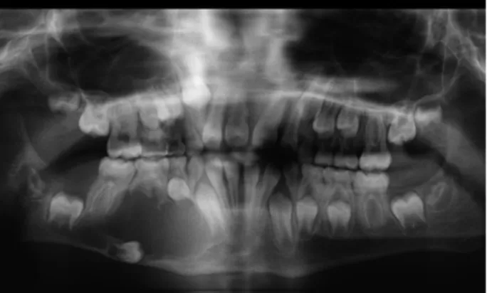 Gambar 2.1 Contoh Citra Rontgen (Knipe, 2015) 