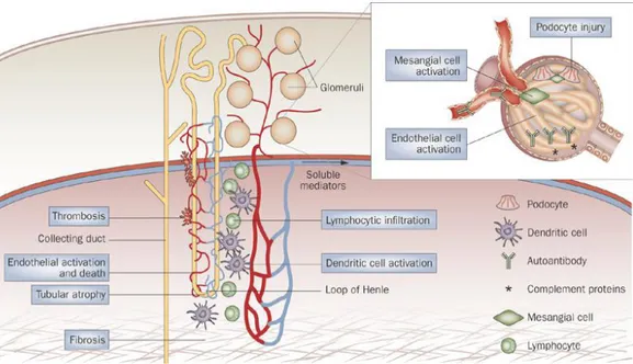Gambar 5. Patogenesis nefritis lupus(Davidson dan Aranow,2010). 