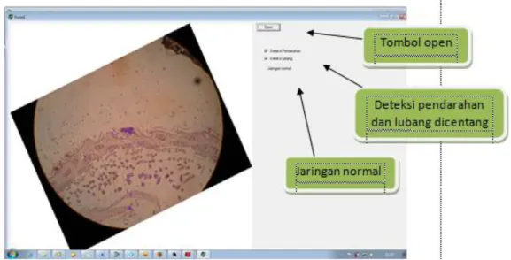 Gambar 3. Tampilan segmentasi warna pada jaringan kulit normal 
