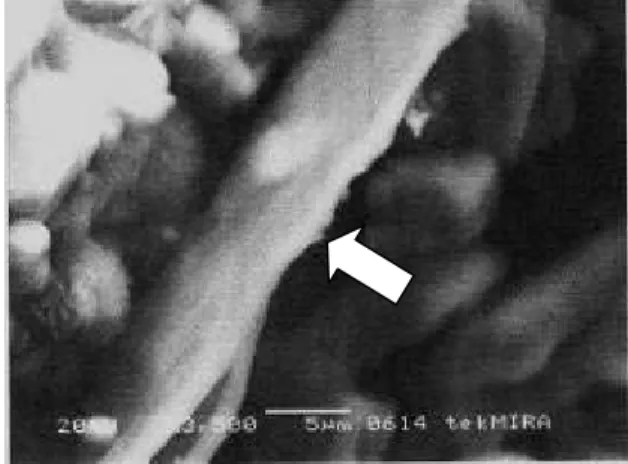 Gambar 3    Scanning electron microscope eksopolisakarida B. cenocepacia strain  KTG  (tanda panah, perbesaran 3500x)