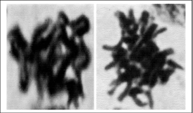 Gambar 4. Preparat kromosom sel anter tanaman  cabe  keriting  setelah  perlakuan  kolkisin (Fotograf  :10  x 100, direpro  menjadi 1500x)