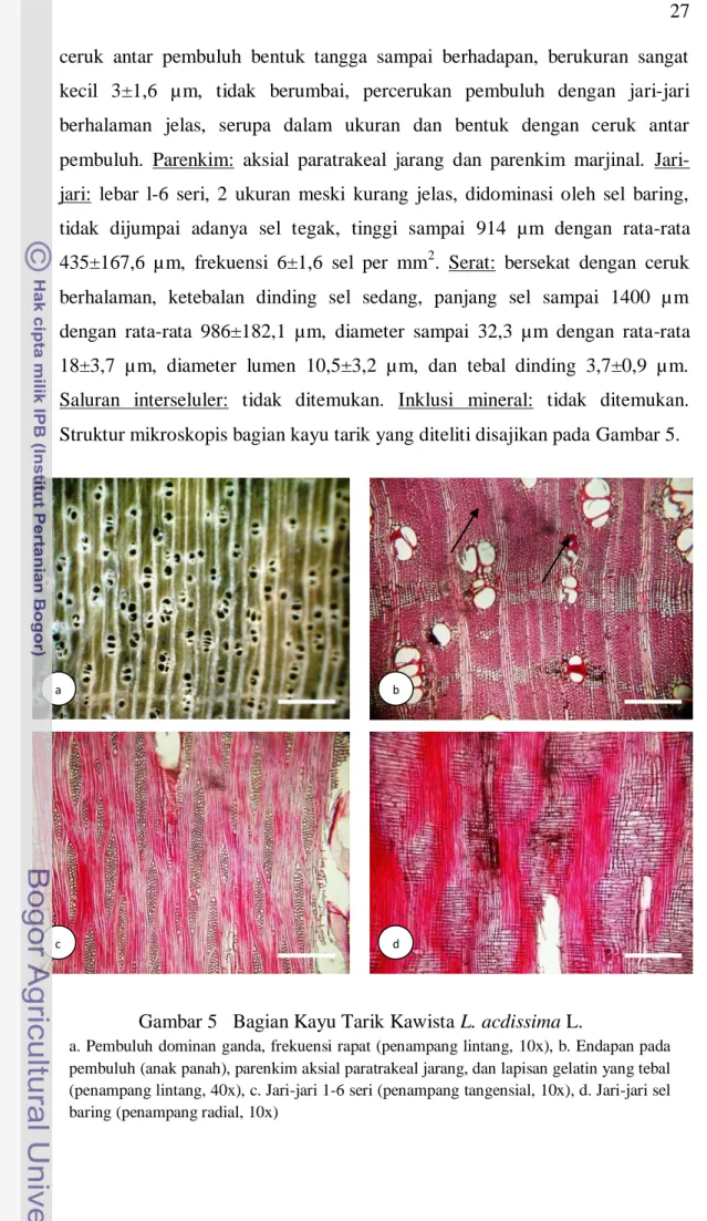 Kajian Struktur Anatomi Dan Kualitas Serat Kayu Normal Kayu Tarik Dan