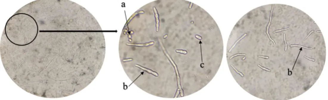 Gambar 3. Uji viabilitas konidia C. acutatum setelah diberi perlakuan sel kamir. (a)  kamir (b) konidia C