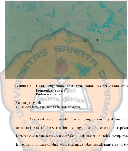 Gambar 3. Hasil Pengecatan Acid Fast Isolat Bakteri dalam Susu ®