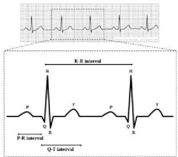 Gambar 2.1 Perhitungan R-R interval yang didapatkan dari sinyal electrocardiogram.  
