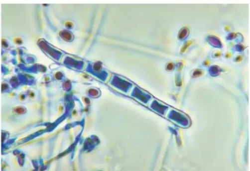 Gambar 2.7 Mikroorganisme Trichophyton rubrum 