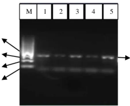 Gambar  4.  Elektroforegram  amplifikasi  lima  sampel  DNA  metagenomik  pengulangan  pertama