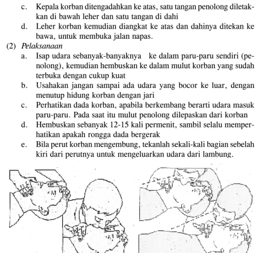 Gambar  4.: Pelaksanaan Pernapasan dari Mulut ke Mulut (Sumber: Youngson 1997:6-7)