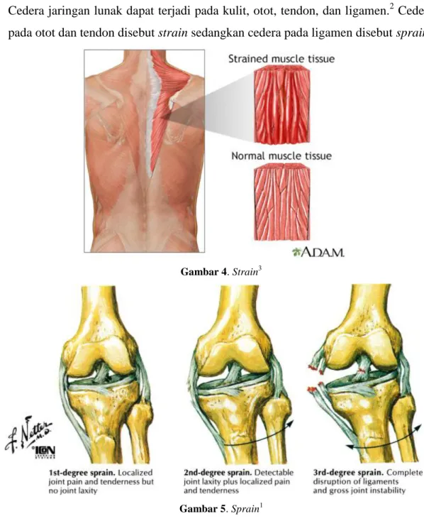 Gambar 4. Strain 3 
