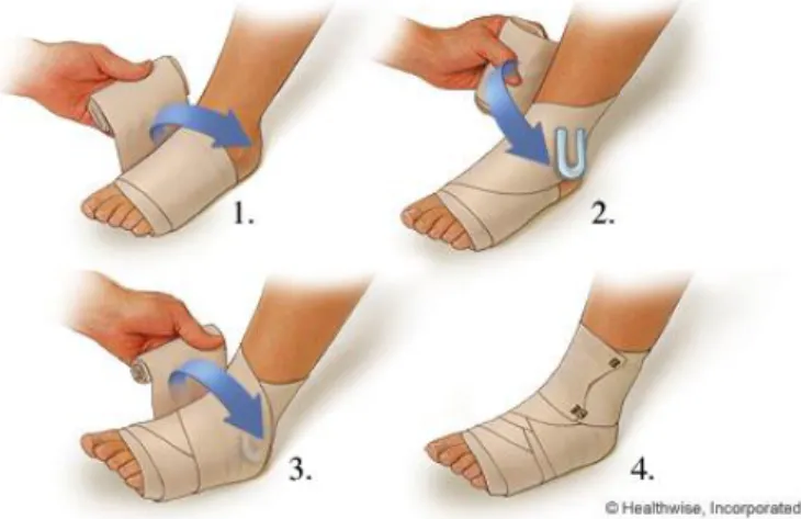 Gambar 8. Kompresi dengan elastic bandage 6