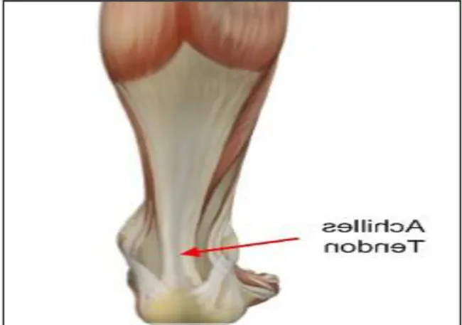 Gambar 15. Cedera tendon achiles 