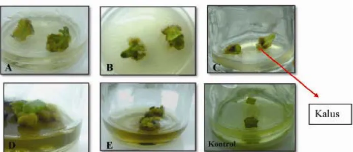 Gambar 2. Kalus eksplan daun sirsak; A =  media MS dengan penambahan  kombinasi NAA 0 mg/l + BAP 4 mg/l, B  