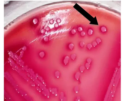 Gambar 2 Koloni diduga  E. coli dalam media agar Mac Conkey 