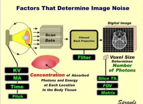 Gambar 2.6. Faktor-Faktor yang Mempengaruhi Noise (Sprawls, 1995) 