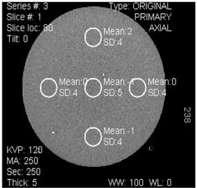 Gambar 2.2. Uji Cross Field Uniformity CT Number Dengan Software ROI  (Sprawls, 1995) 