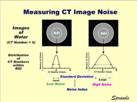 Gambar 2.3  Pengukuran Nilai Noise Pada CT Scan dengan Software ROI  (Sprawls, 1995) 