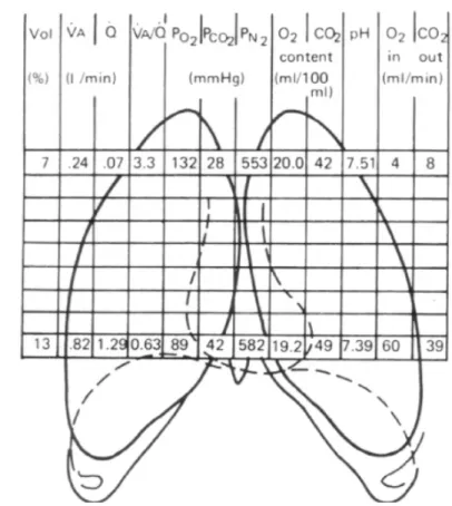 Gambar 5. Diagram skematik menggambarkan 3 unit paru: normal, shunt dan dead space 8,9