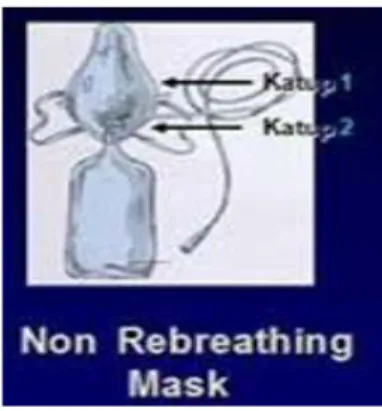 Gambar 2.5 Non Rebreathing Mask  b.  Sistem Aliran Tinggi 