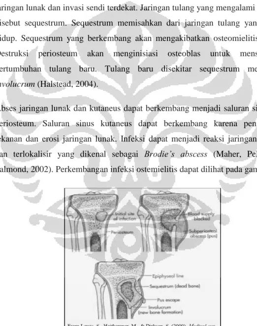 Gambar 2.1 Perkembangan Infeksi Osteomielitis  