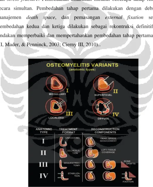 Gambar 2.2 Varian Osteomielitis dan Jenis Tindakan Pembedahan  