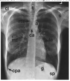 Gambar 2.3 : Anatomi Radiografi Toraks Normal (lange)
