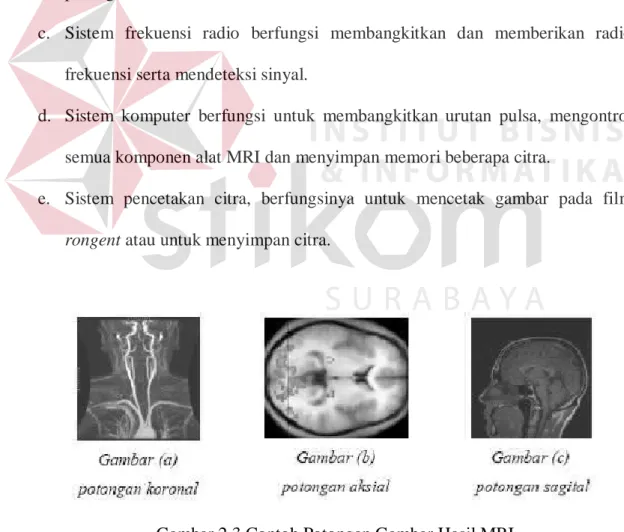 Gambar 2.3 Contoh Potongan Gambar Hasil MRI 