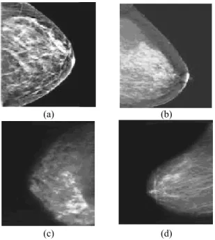 Gambar 4 Data citra mammogram 