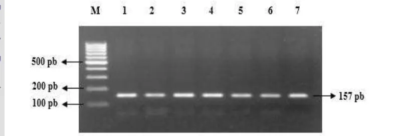 Gambar 5 Visualisasi elektroforesis amplifikasi gen κ-Kasein pada gel agarosa   