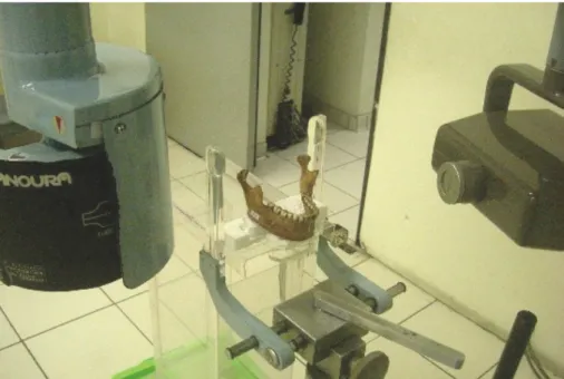 Gambar 1. Posisi Preparat Tulang Mandibula pada Pengambilan Radiograf Panoramik