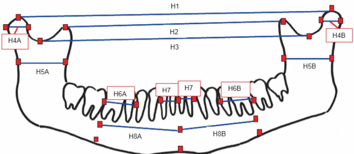 Gambar  2. Posisi Metal  Marker dan Garis Imajiner Pengukuran Horizontal pada Preparat Tulang  Mandibula (acuan pengukuran horizontal dimodifiksai dari penelitian Amir et al., 1998)