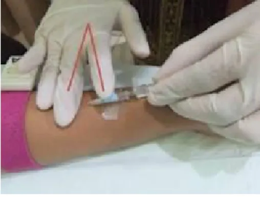 Gambar 9. Pemasangan Infus 