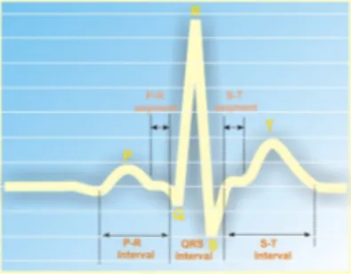 Gambar Sinyal ECG 