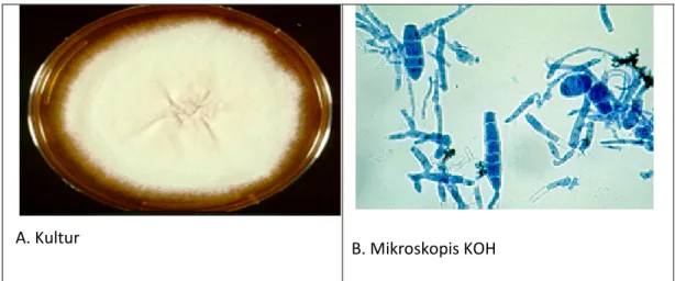 Gambar 2.12: A. Gambaran Kultur Microsporum gallinae dan  B. Gambaran Mikroskopis KOH Microsporum gallinae