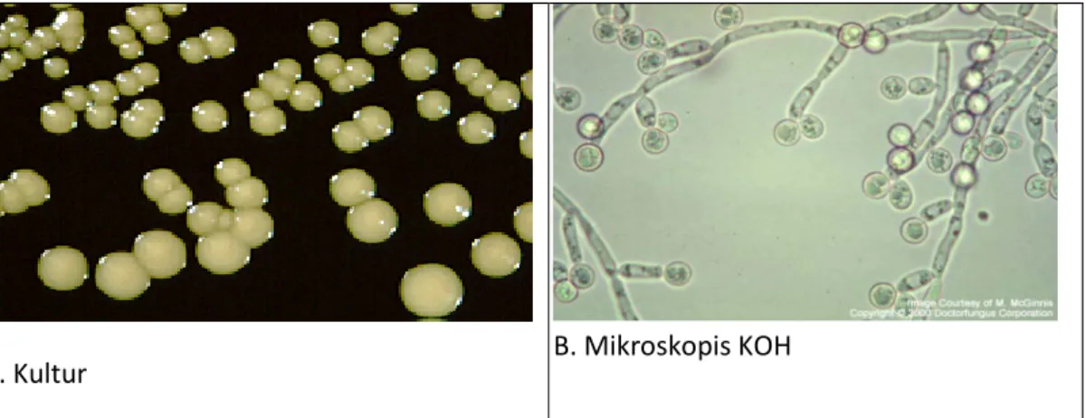 Gambar 2.14: A. Gambaran Kultur Candida albicans dan   B. Gambaran Mikroskopis KOH Candida albicans