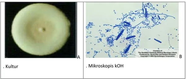 Gambar 2.2: A. Gambaran Kultur Trichophyton Mentagrophytes dan  B. Gambaran Mikroskopis KOH Trichophyton Mentagrophytes