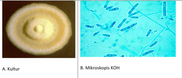 Gambar 2.8: A. Gambaran Kultur Trichophyton terrestre dan   B. Gambaran Mikroskopis KOH Trichophyton terrestre