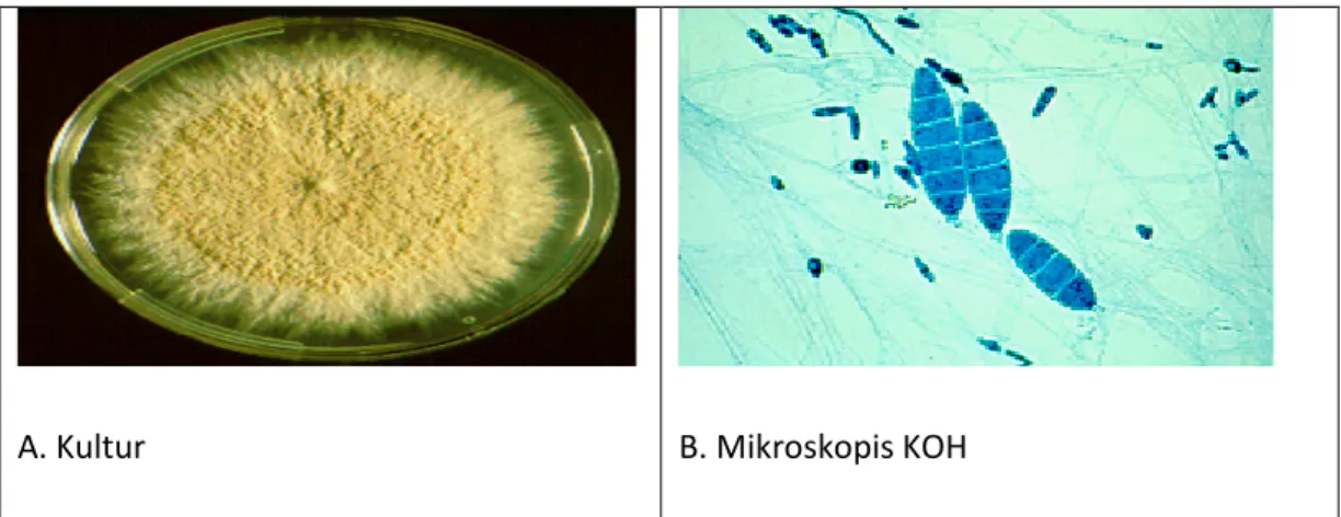 Gambar 2.10: A. Gambaran Kultur Microsporum gypseum dan  B. Gambaran Mikroskopis KOH Microsporum gypseum