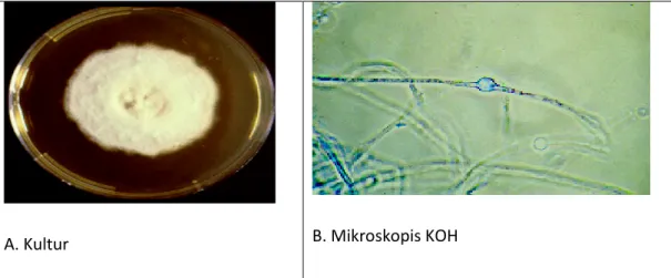 Gambar 2.11: A. Gambaran Kultur Microsporum audouinii dan   B. Gambaran Mikroskopis KOH Microsporum audouinii